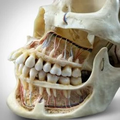 RARE-T Human Skull - Authentic Human Skull Anatomical Preparation With Custom Case