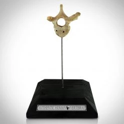 RARE-T Human Vertebrae - Authentic Human Vertebrae Display Stand