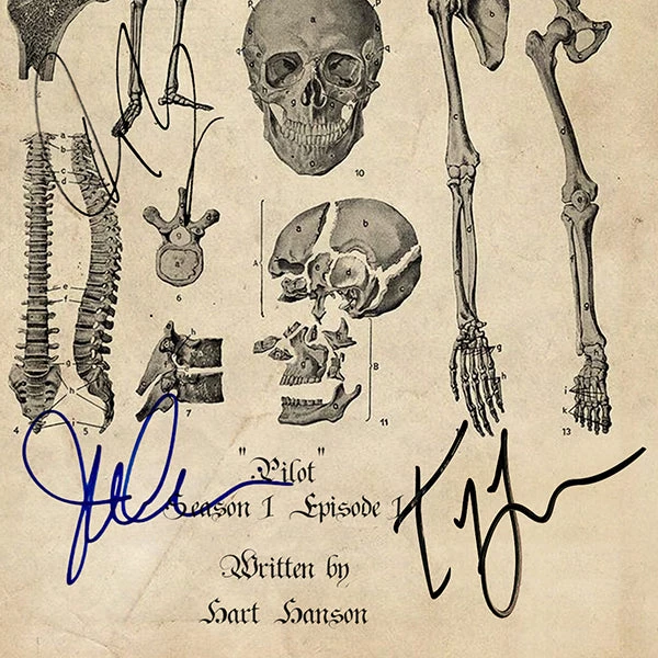 RARE-T Bones Script Limited Signature Edition Studio Licensed Custom Frame Limited Edition Frames 5 RARE-T Bones Script Limited Signature Edition Studio Licensed Custom Frame Limited Edition Frames